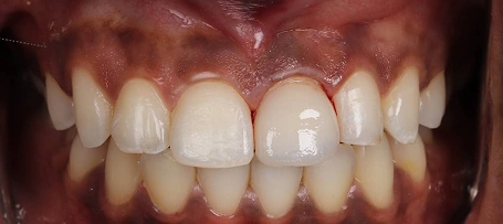 TMJ Treatment in Fairhope